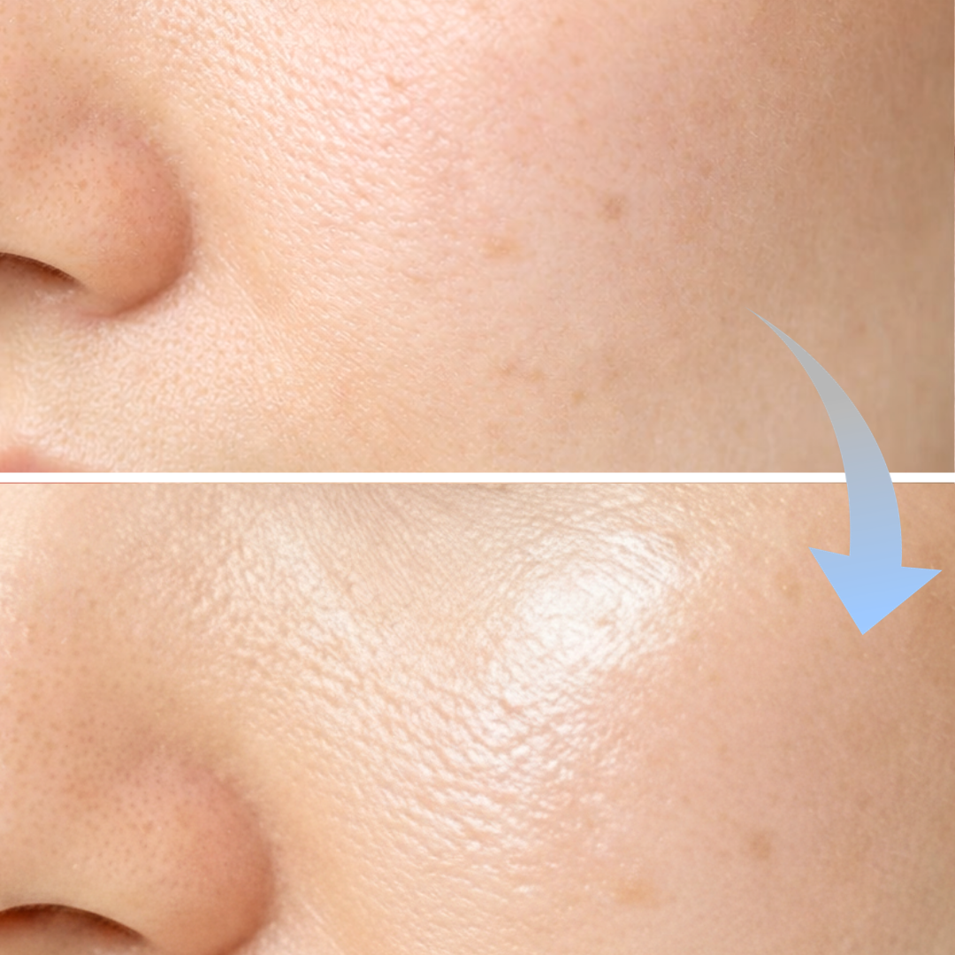 京都・四条烏丸｜コラーゲン生成のビフォーアフターの写真