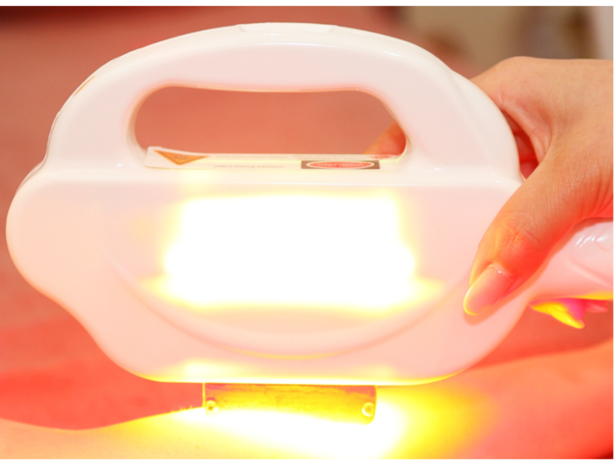 痛みに配慮した光脱毛機でVIO脱毛を行う施術風景