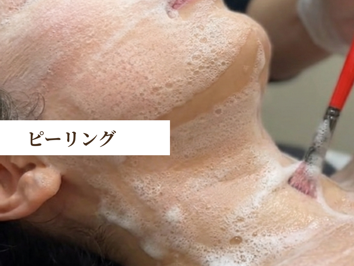 ララピールの剥離なしピーリング施術中の様子。敏感肌でも安心して肌質改善できる肌ケア。