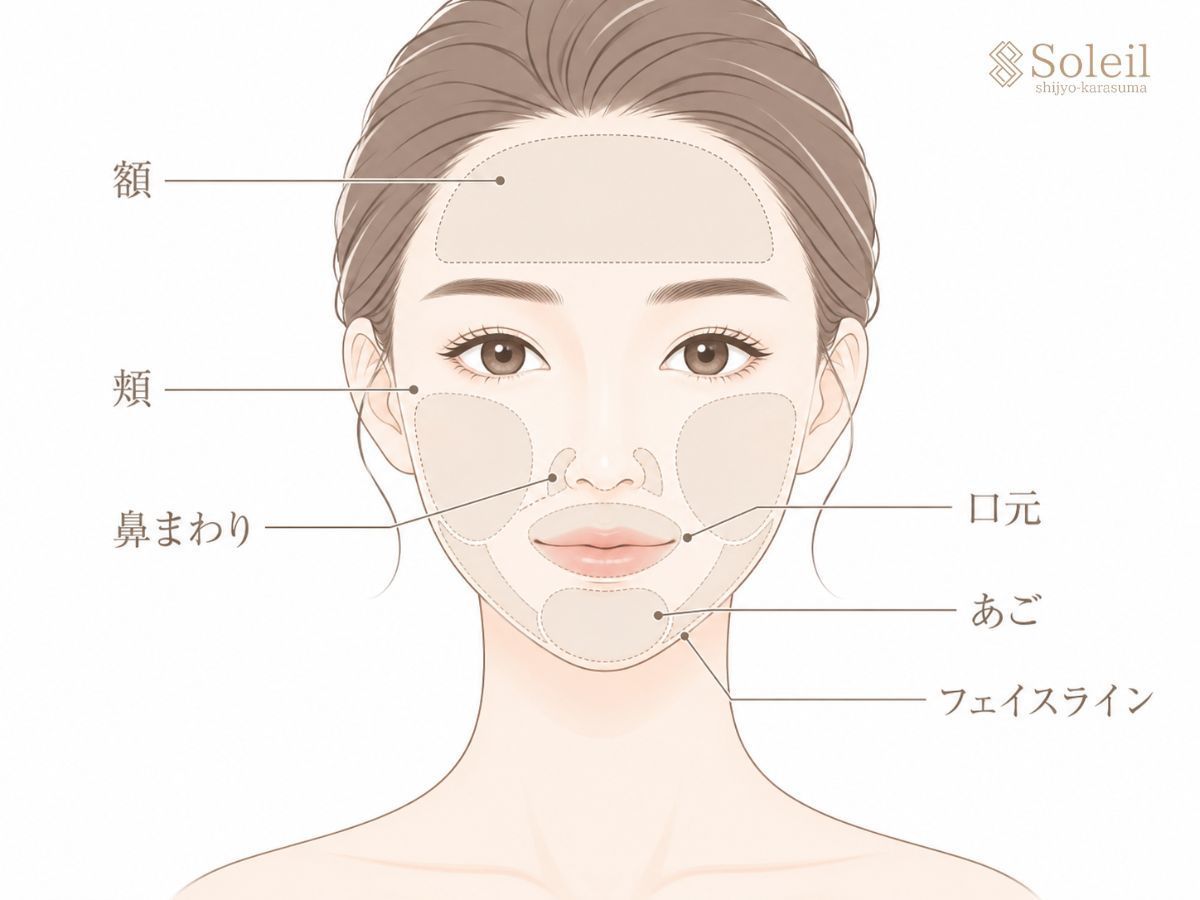 顔脱毛の施術範囲｜額・頬・鼻まわり・口元・あご・フェイスライン