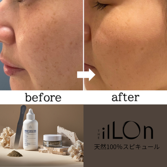 京都・四条烏丸｜フェイシャルピーリング